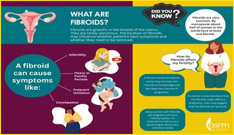 Does subserosal fibroid cause infertility?
