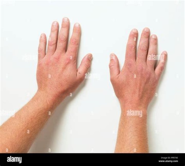 A pair of hands stretching out to the burning sun A pair of hands stretching out to the burning sun