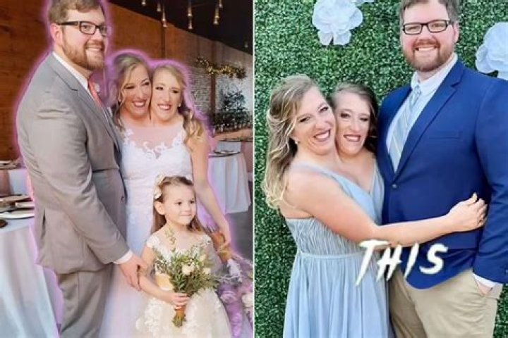 Al Stanley Viral Abby Brittany Hensel Sad News