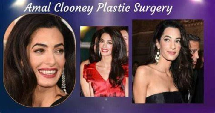 Amal Clooney Plastic Surgery: A Comprehensive Look At Her Transformation