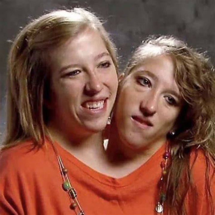 Conjoined twins Abby and Brittany Hensel chose very surprising Taylor