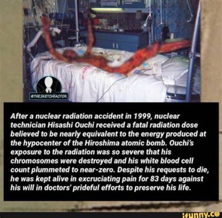 Exploring The Tragic Story Of Hisashi Ouchi: A Survivor Of The Tokaimura Nuclear Accident