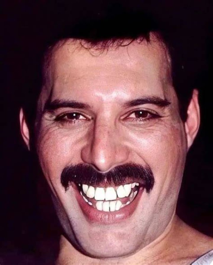 Freddie Mercury's teeth: What is the story behind his iconic smile?