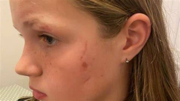 girl gets attacked by Great Dane YouTube
