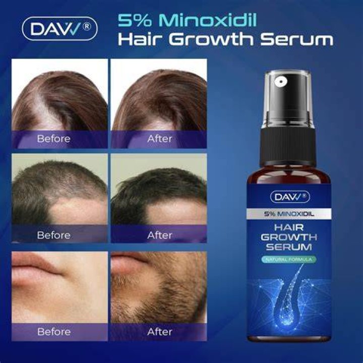 Hair growth and strength serum, oil. long beautiful hair Amazing Hair