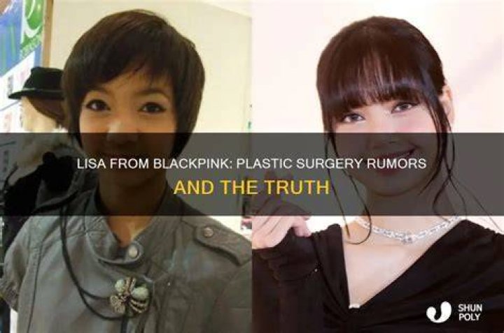 Has Lisa Had Plastic Surgery? Her Transformation in Photos From