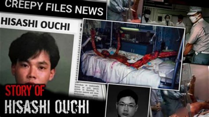 Hisashi Ouchi Death Photo: The Tragic Story Behind The Incident