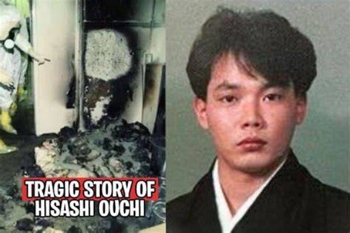Hisashi Ouchi Death Picture: The Tragic Story Behind The Incident