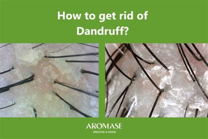 How To Get Rid Of Dry Shampoo Buildup