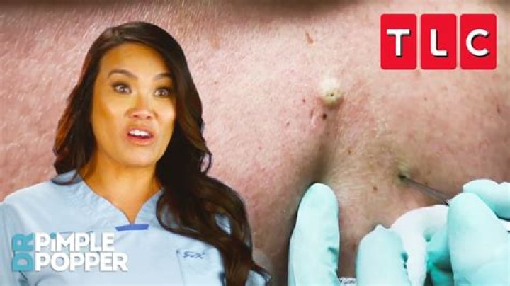 Is Dr. Pimple Popper On Hulu?