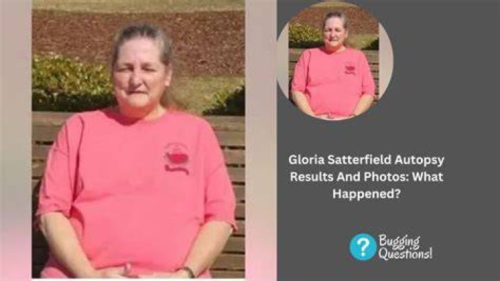 Is Gloria Sick What Happened To Her Face? Illness