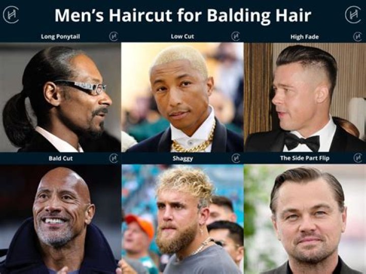 Jason Hoppy: The Journey Of A Man Embracing His Baldness
