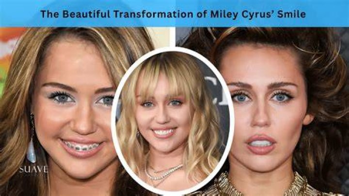 Kider&uuml;lt, Miley Cyrus mi&eacute;rt csak most, &eacute;vekkel k&eacute;sőbb adta ki a