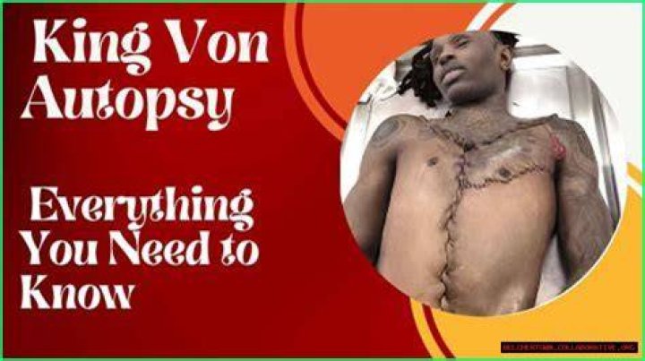 Kong Von Autopsy Unraveling The Mystery Behind The Name