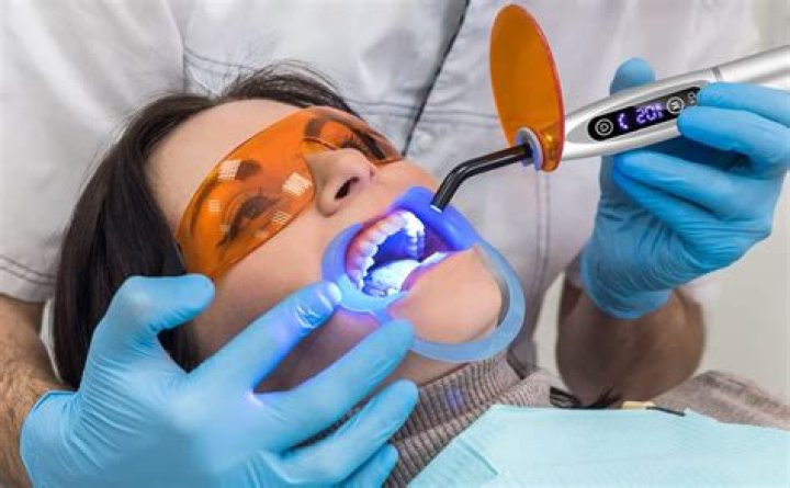 LAMPARA PARA FOTOCURADO APPLE DENTAL Dep&oacute;sito Dental Naucalpan