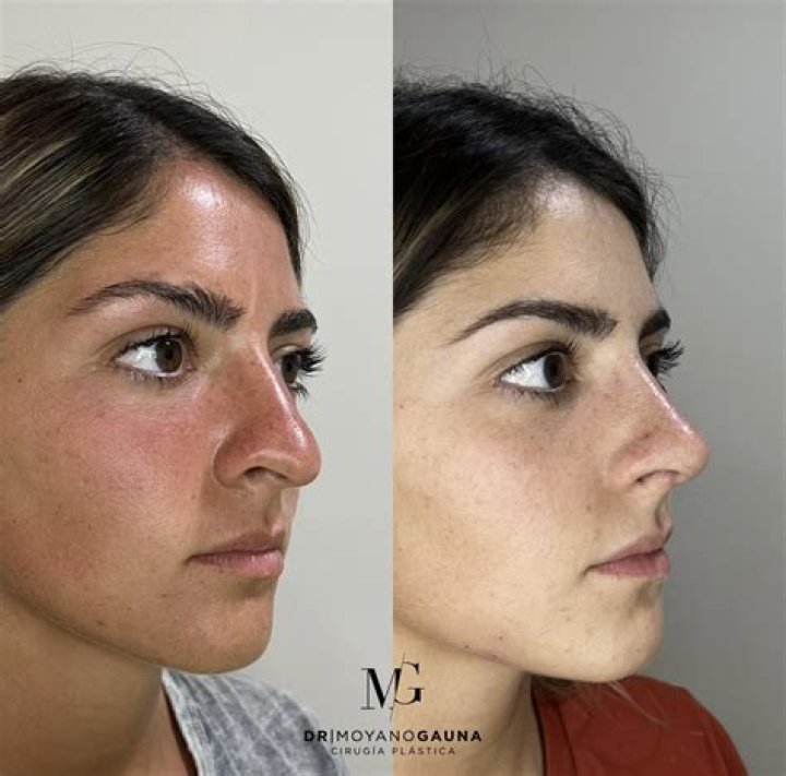 Luc&iacute;a M&eacute;ndez antes y despu&eacute;s, as&iacute; luc&iacute;a de joven Fama
