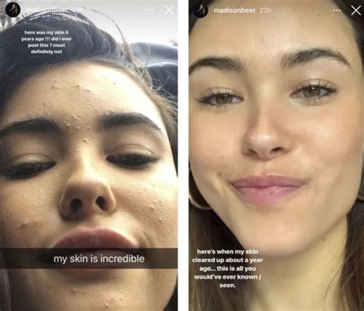 Maddison Beer Leaked: What You Need To Know