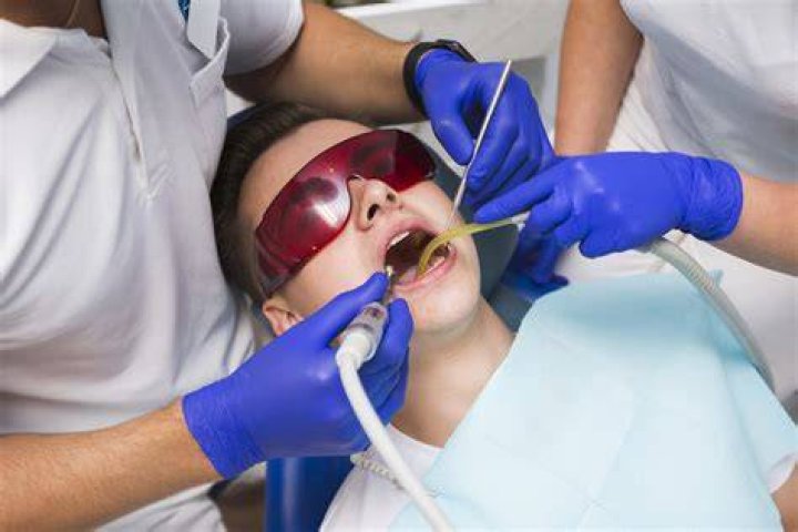 Resina De Fotocurado Dental Todo Lo Que Necesitas Saber Dr Eduardo COLL