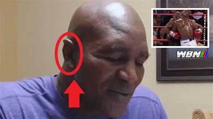 REVEALED: The Truth Behind the Evander Holyfield Steroid Allegations