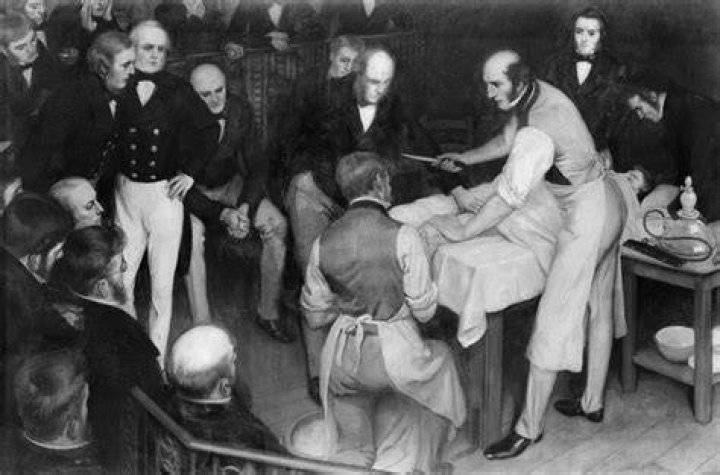 Robert Liston operating, by Ernest Board of Bristol (1877-1934), and this was one of the paintings he was commissioned to paint by Henry S. Wellcome circa 1912. Photo / Wellcome Collection