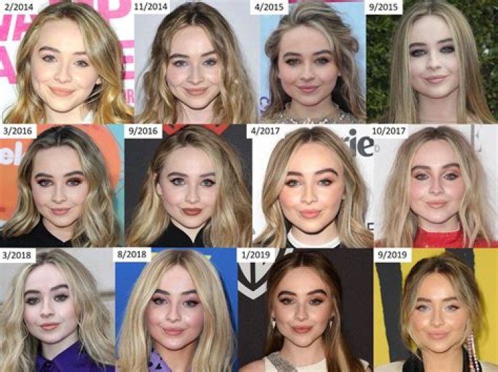 Sabrina Carpenter Plastic Surgery Botox And Lip Filler