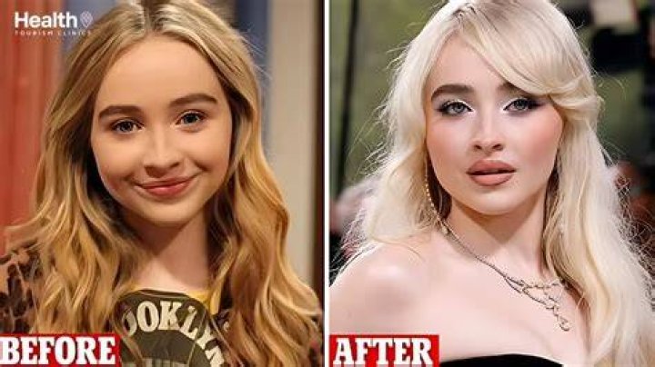 Sabrina Carpenter Surgery: What You Need To Know