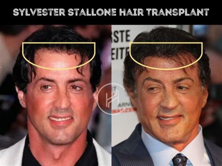 Sylvester Stallone Hair: A Comprehensive Look At His Iconic Hairstyles