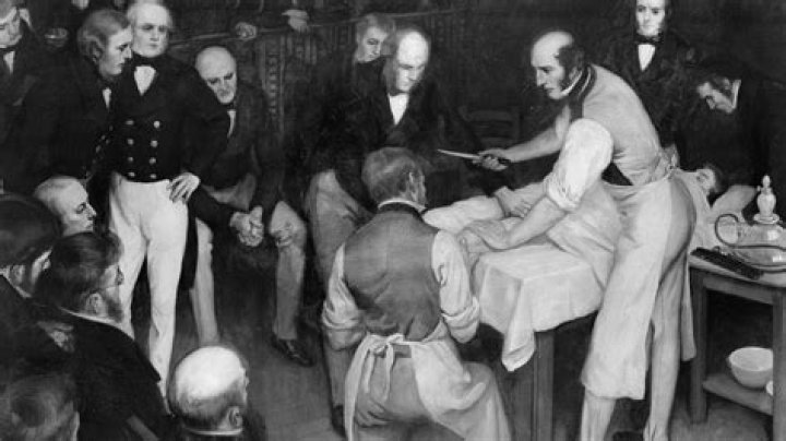 Terror of the 19th century operating table: No drugs and patients were fully awake