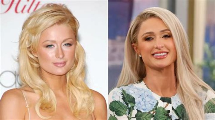The Ultimate Guide To Paris Hilton's Plastic Surgery Journey