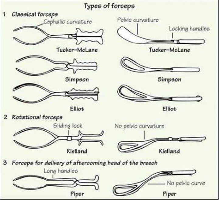 This type of forceps was invented by Robert Liston (1794-1847), an English surgeon famous for his speed and skill in surgery. Photo / Supplied