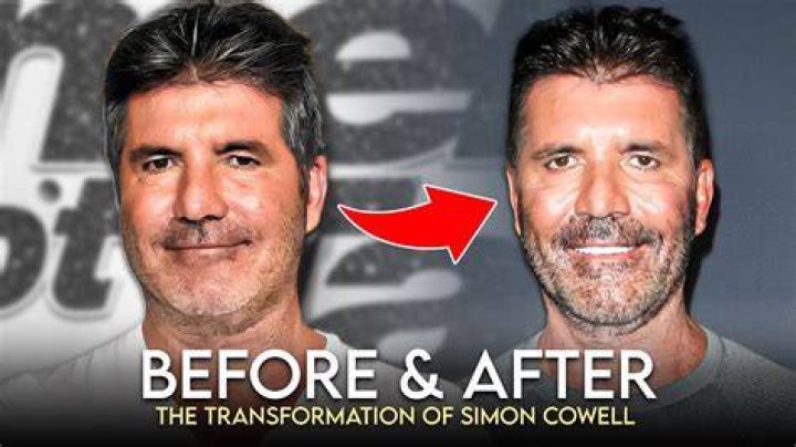 What's Wrong With Simon Cowell's Son? A Deep Dive Into The Life Of Eric Cowell
