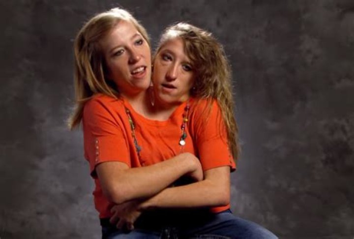 What Famous Conjoined Twins Abby And Brittany Hensel are Doing Today