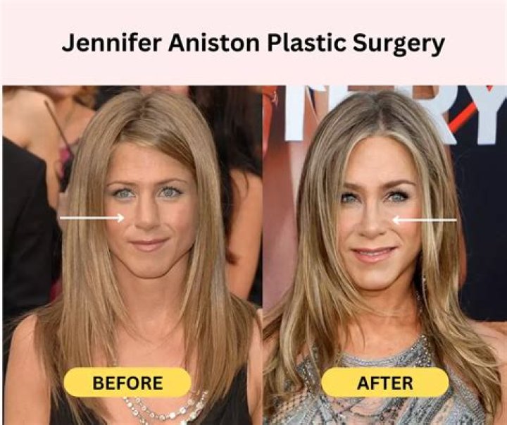 What Plastic Surgery Has Harry Connick Jr. Had? Plastic Surgery Talks