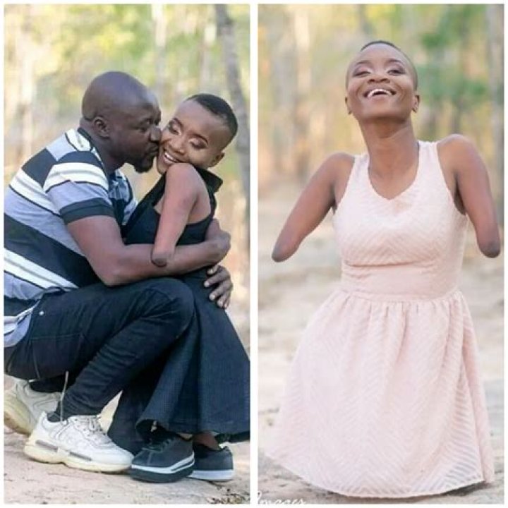 Zimbabwean motivational speaker born without limbs reveals she is pregnant